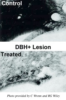 Anti-DBH-SAP