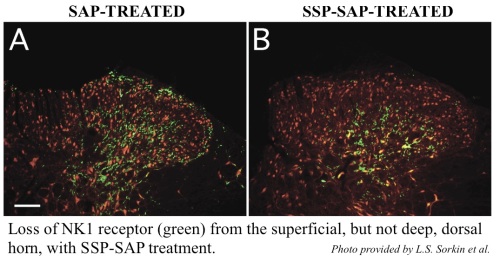 SSP-SAP
