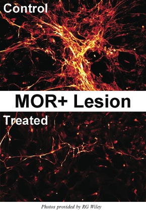 MOR-SAP