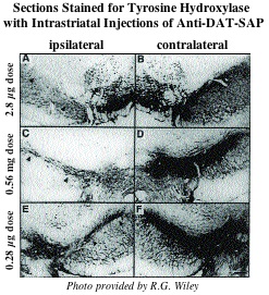 Anti-DAT-SAP