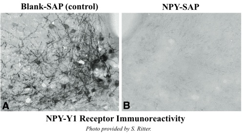 NPY-SAP