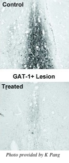 Anti-GAT1-SAP