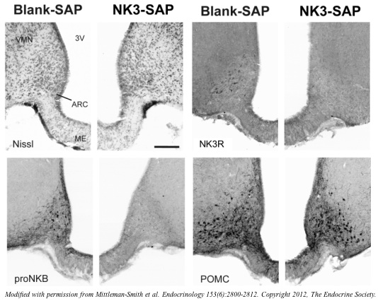 NK3-SAP